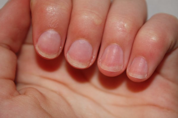 Comment arrêter de se ronger les ongles ?